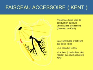 http://art-to-act.org/wp-content/uploads/2020/01/FAISCEAUACCESSOIREKENT-300x300.jpg